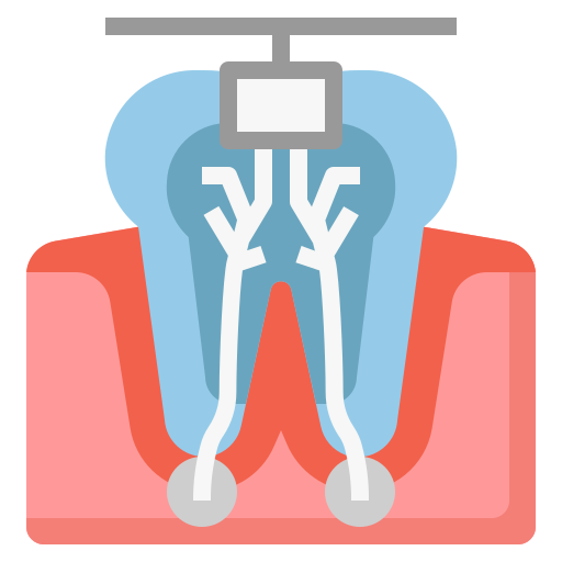 Konservasi Gigi Endodonsi